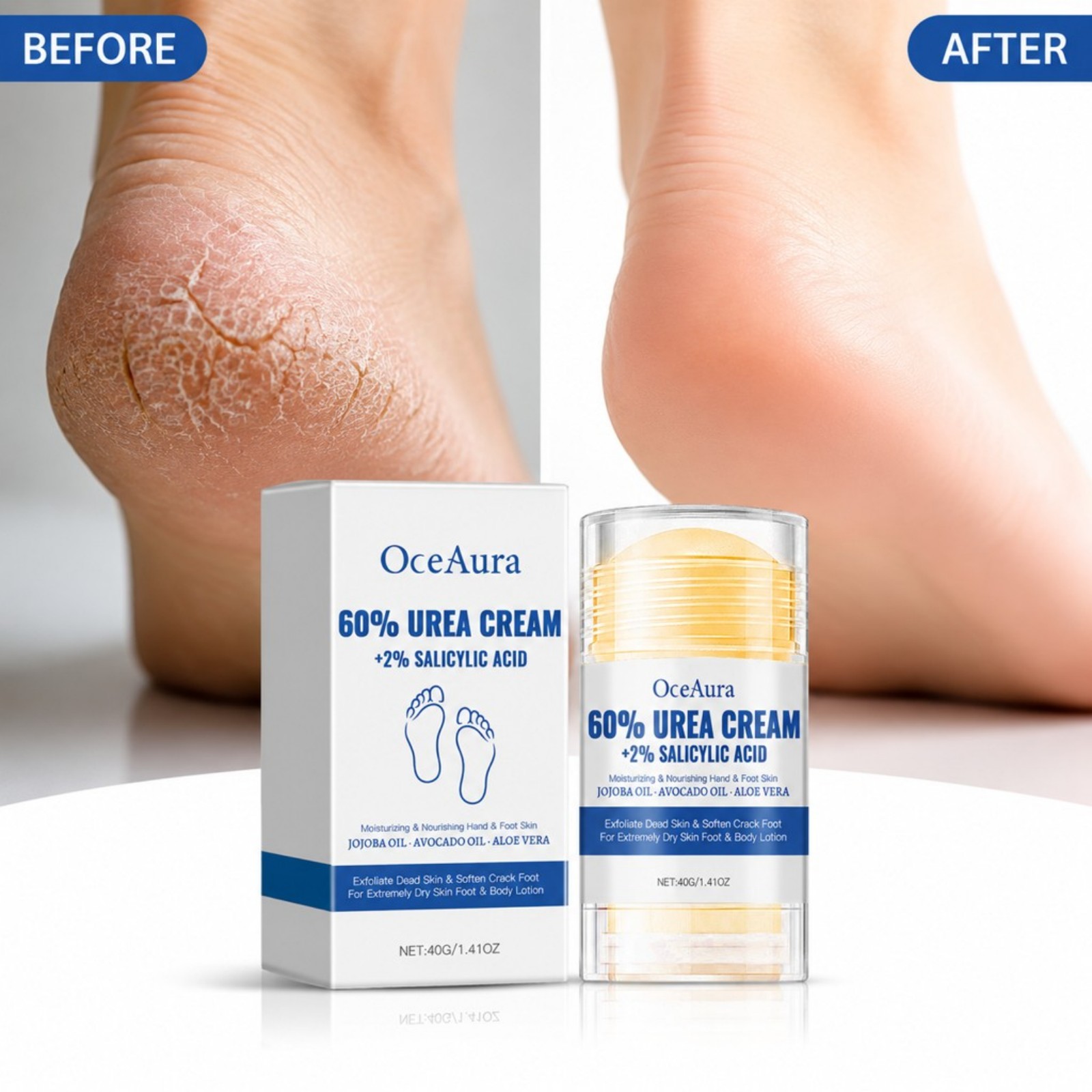 60% Urea Foot Care Cream Stick - Urea Foot Cream review and price