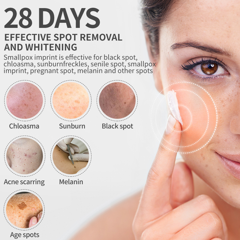 Dimollaure Whitening Freckle C - Retinol Cream review and price